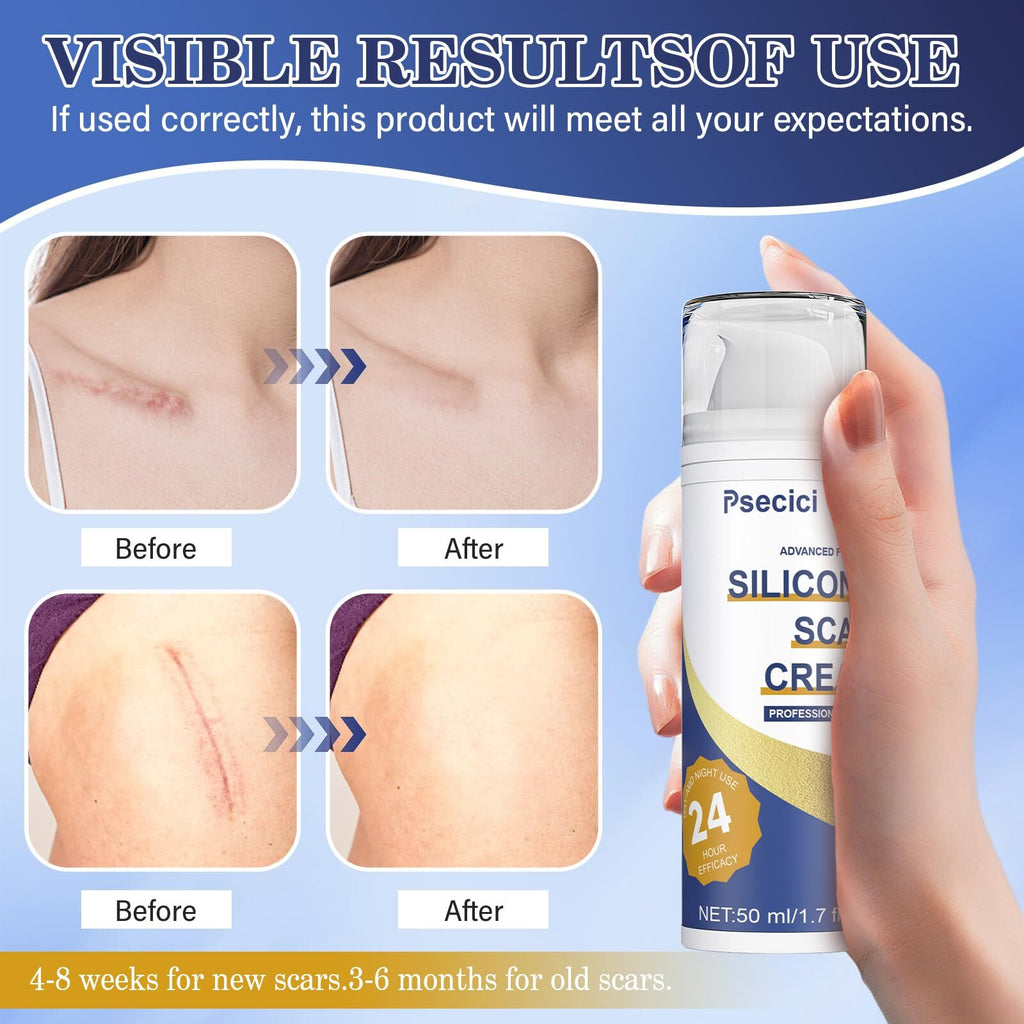Psecici Scar Cream,Silicone Scar Gel,Advanced Scar Gel,Scar Removal Cream For