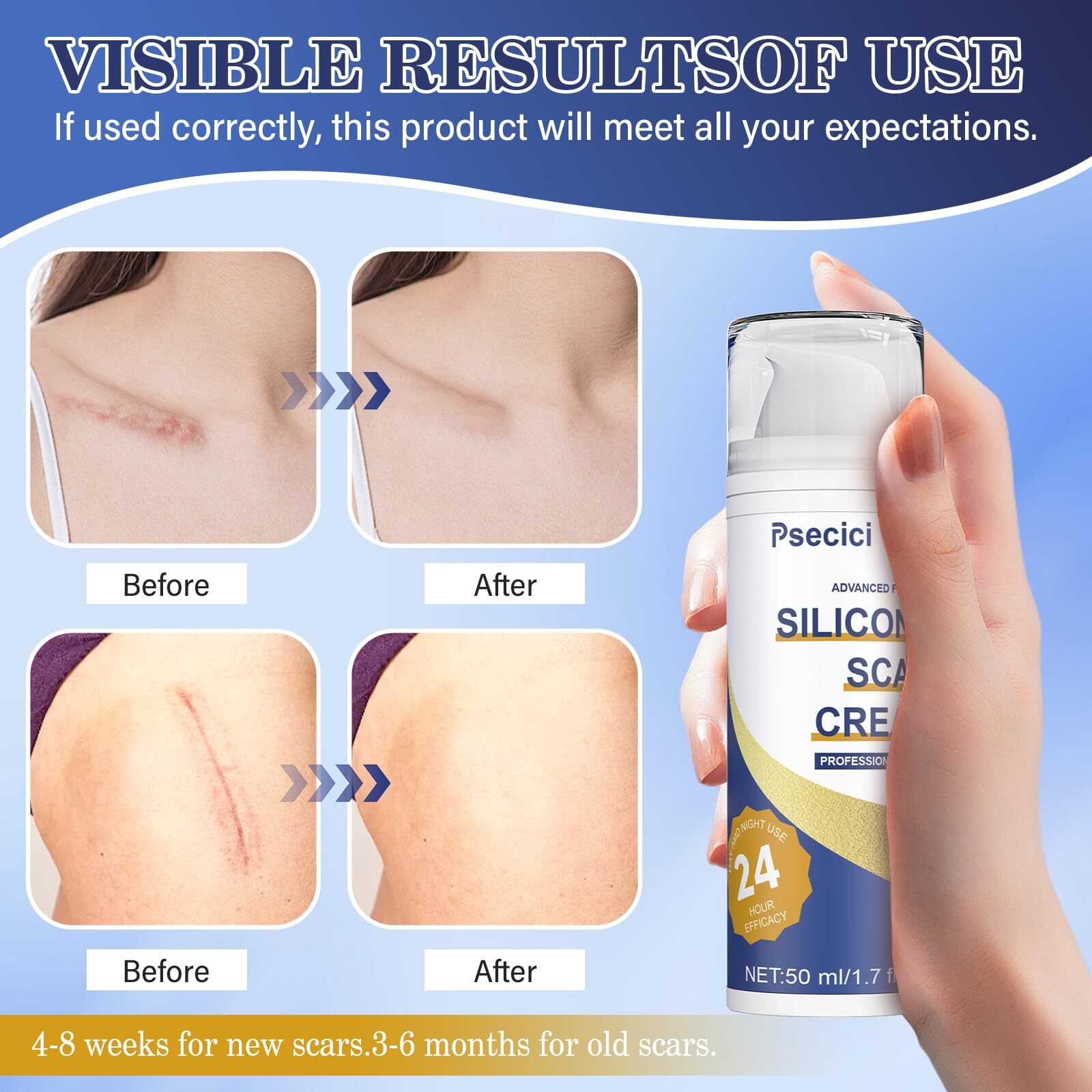 Psecici Scar Cream,Silicone Scar Gel,Advanced Scar Gel,Scar Removal Cream For