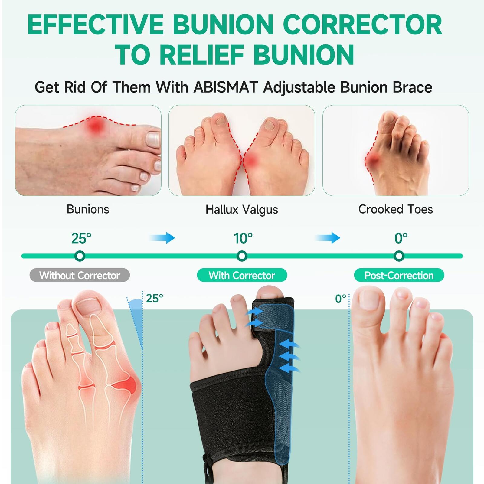 Abismat 2 Pcs Bunion Corrector for Women Men Big Toe, Non-Slip Big Toe Splint